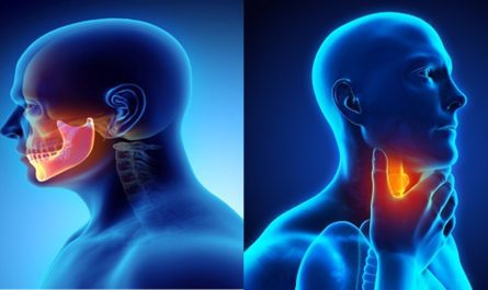 Head and Neck Cancer Drugs Market