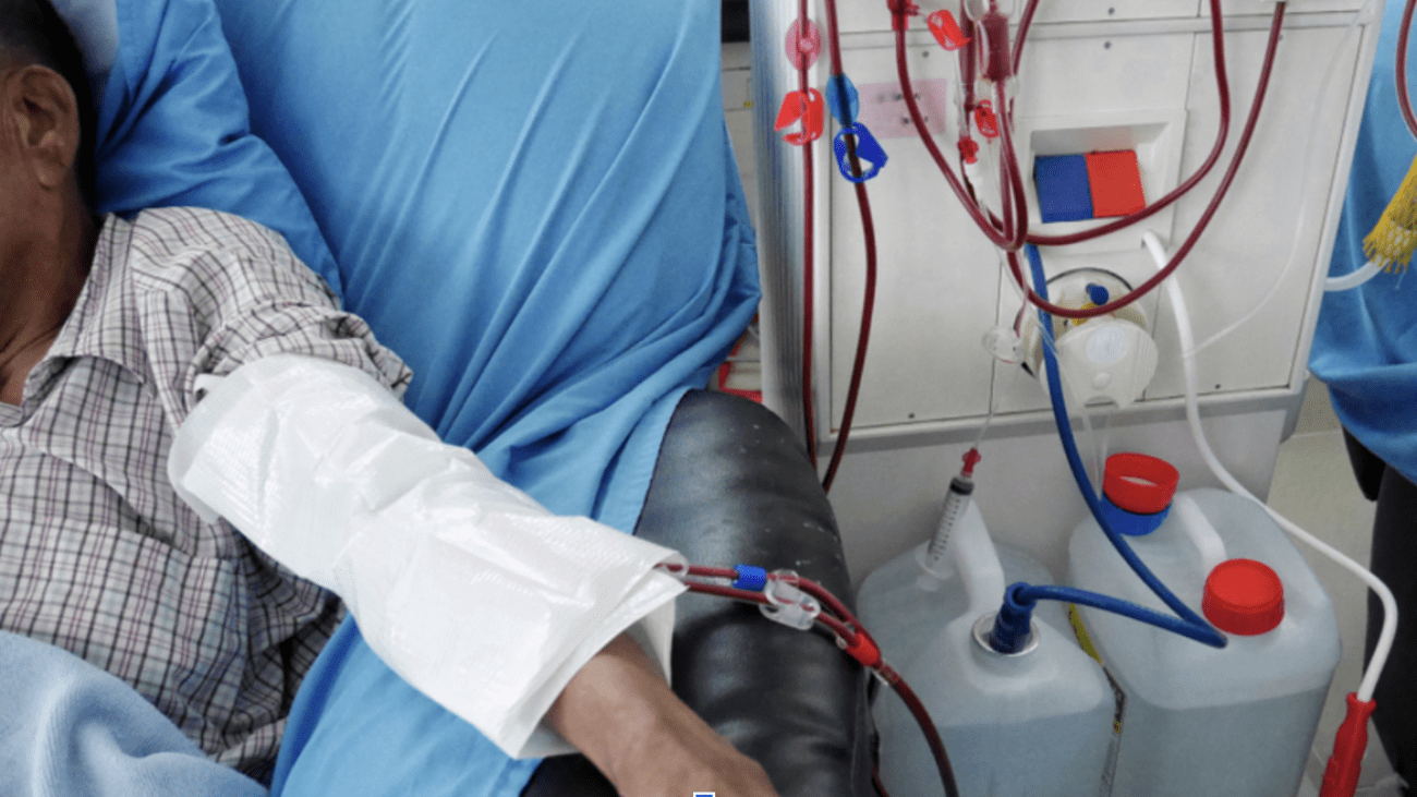 Global Kidney Dialysis Equipment Market