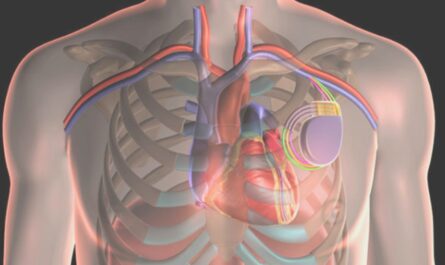 Cardiac Prosthetic Devices Market Size And Share