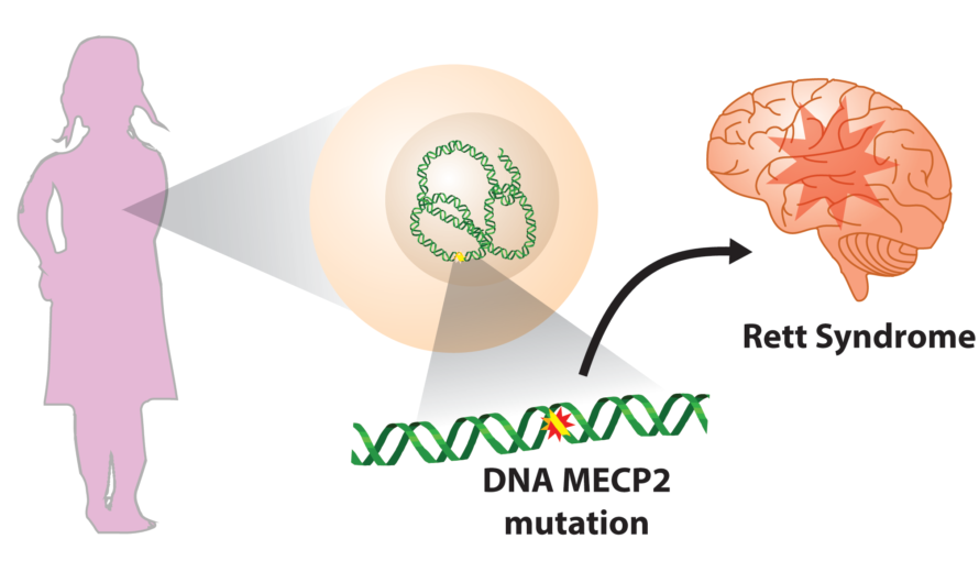 Newly Identified and Characterized MECP2 Gene Variant Sheds Light on Rett Syndrome