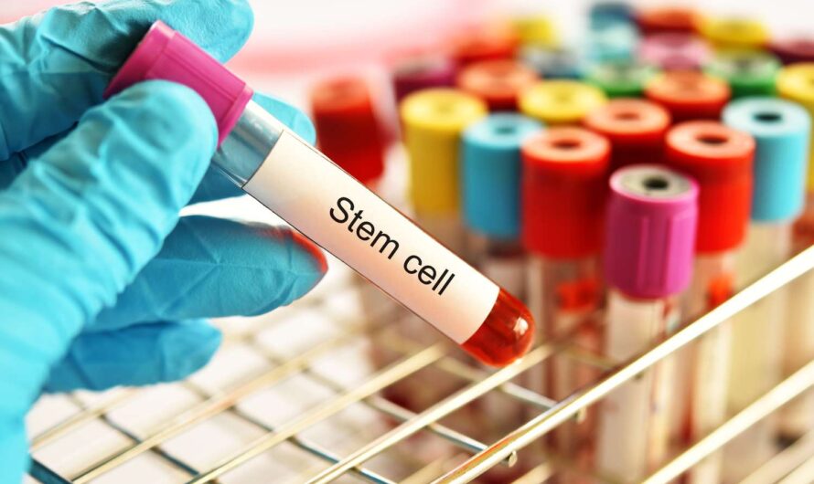 Stem Cell Banking Market Experiences Growth Owing To Rising Focus On Regenerative Medicine