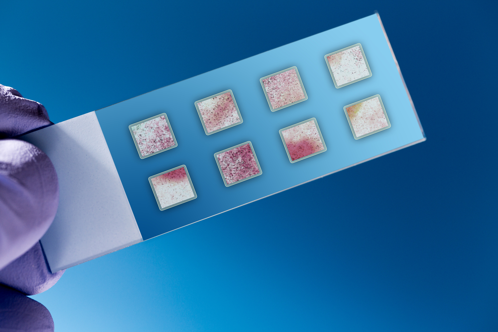 Lab-on-a-Chip and Microarray Biochip Market