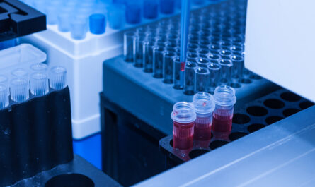 Transfection Reagents And Equipment Market