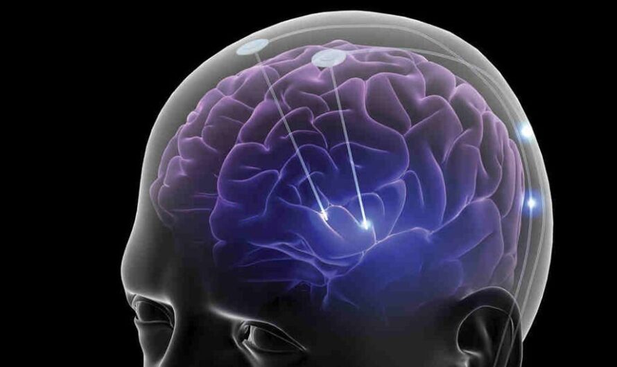 New Ultrasound Tool Shows Potential to Enhance Delivery of Alzheimer’s Drugs to the Brain