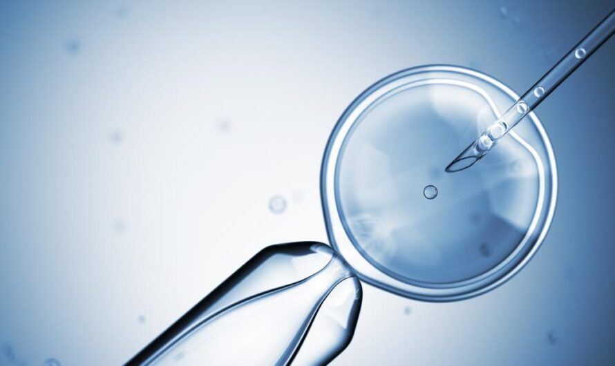 The Global Artificial Insemination Market Is Estimated To Propelled By Rising Cases Of Infertility, Artificial Insemination Market