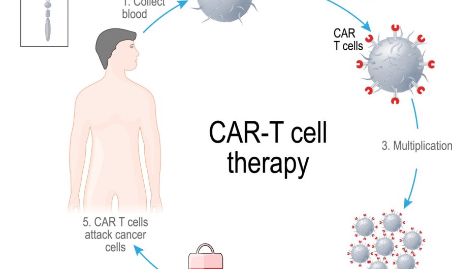 CAR T Cell Therapy Market Is Expected To Be Flourished By Novel Immunotherapies