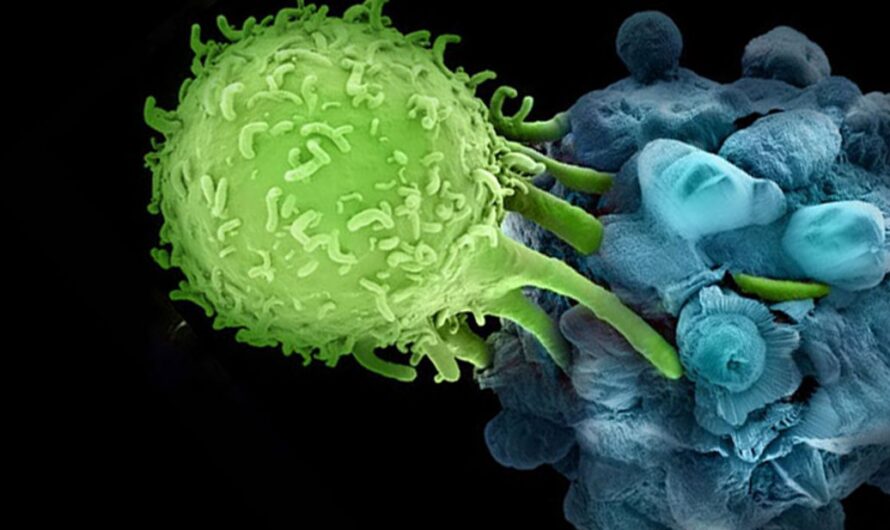 Cancer Immunotherapy is Expected to be Flourished by Growing Adoption of Targeted Immunotherapies