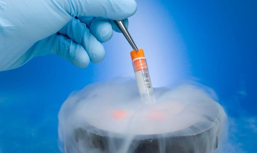 The Growing Demand For Cell Preservation Is Driving The Cell Cryopreservation Market