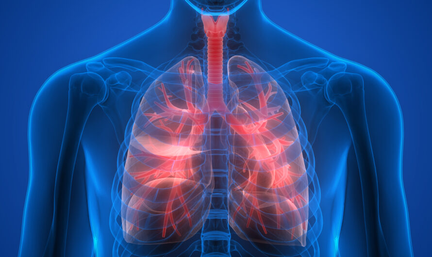 The global Pulmonary Edema Therapeutics Market Growth Accelerated by Increasing Incidence of Respiratory Diseases