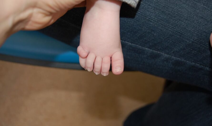 Identification of Rare Disorder Causing Extra Fingers and Toes