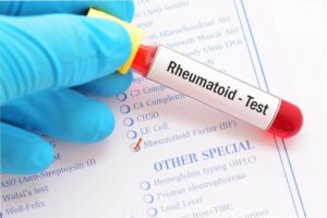 Rheumatoid Arthritis Diagnostic Tests
