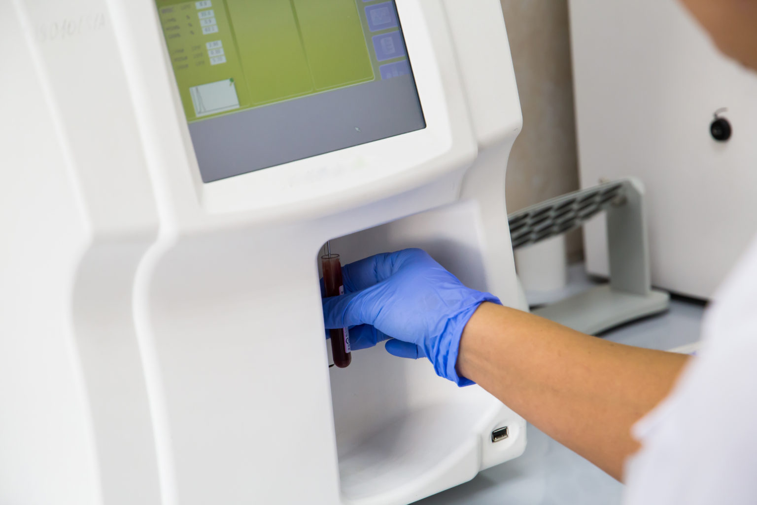 Blood Gas Analyzers Market