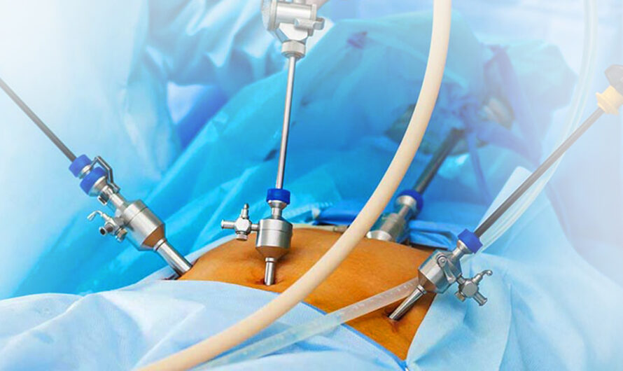 The Global Laparoscopic Electrodes Market is Poised to Witness High Demand Due to Increasing Preference for Minimally Invasive Surgeries