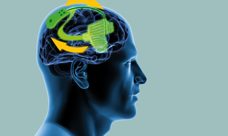 Global Neuroprosthetics : Taking Human Enhancement To The Next Level