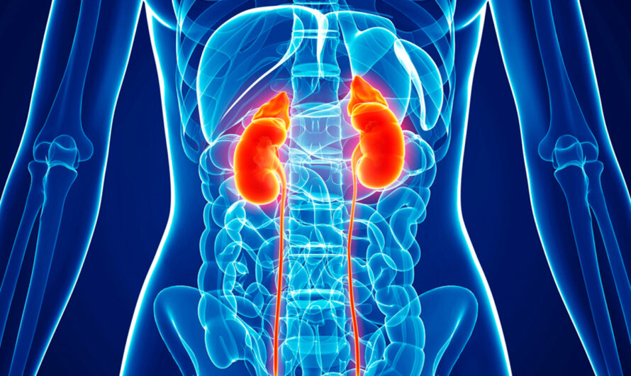 Newly Discovered Unknown Risk Factor Linked to Elevated Rates of Kidney Cancer: Global DNA Study Reveals